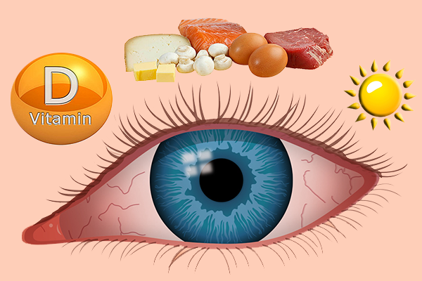 Сухость глаз и источники витамина D